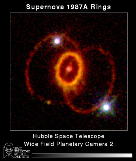 [Image of SN1987A_Rings]